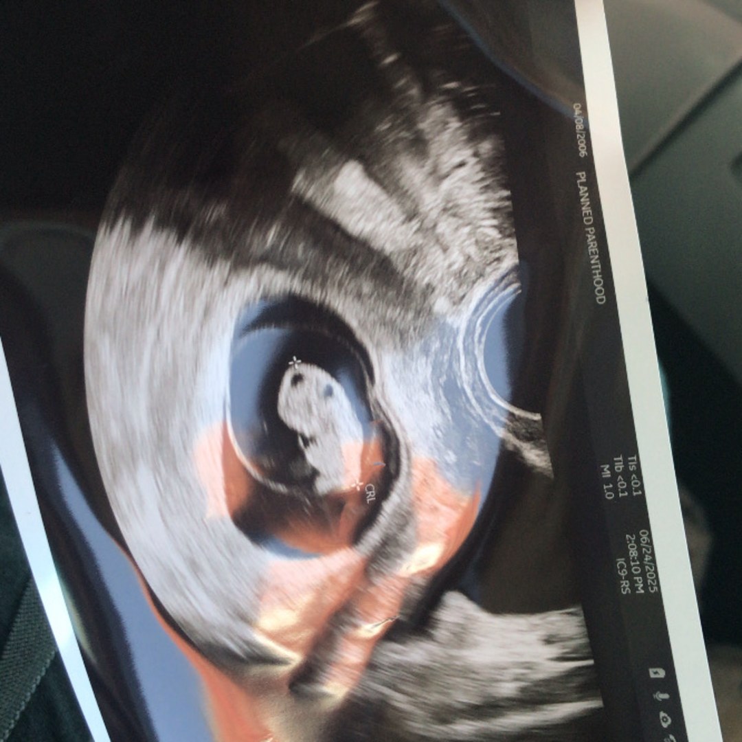 Photo shared by Ailed for their Babylist baby registry.