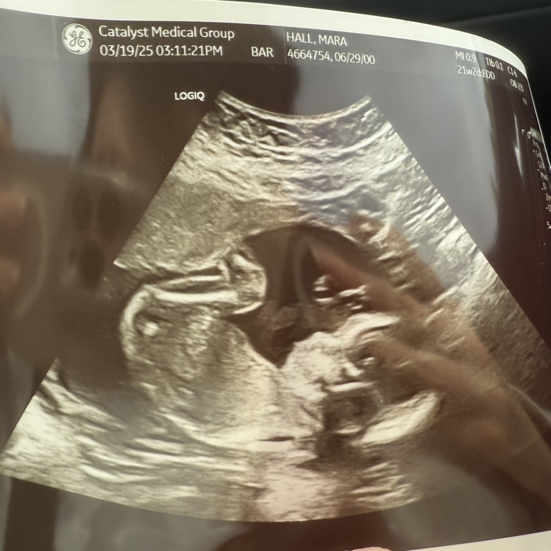 Photo shared by Mara for their Babylist baby registry.