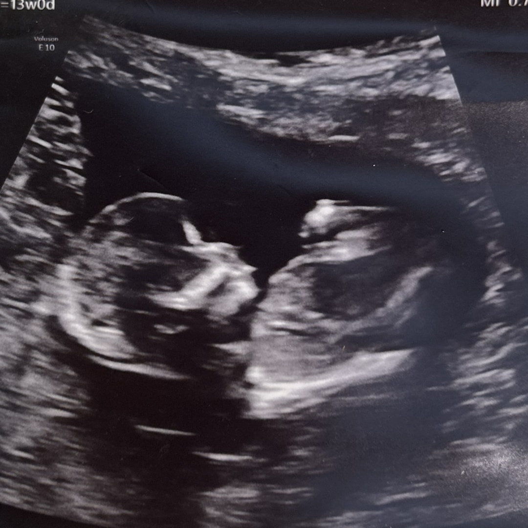 Photo shared by Autumn for their Babylist baby registry.