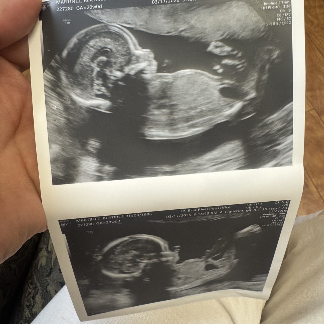 Photo shared by Beatrice for their Babylist baby registry.