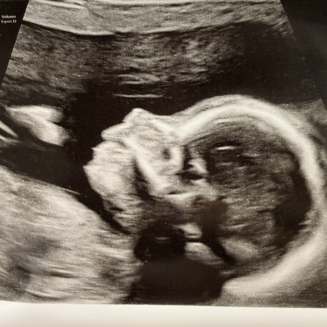 Photo shared by Jenna for their Babylist baby registry.