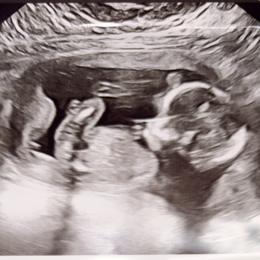 Photo shared by Kaylee for their Babylist baby registry.