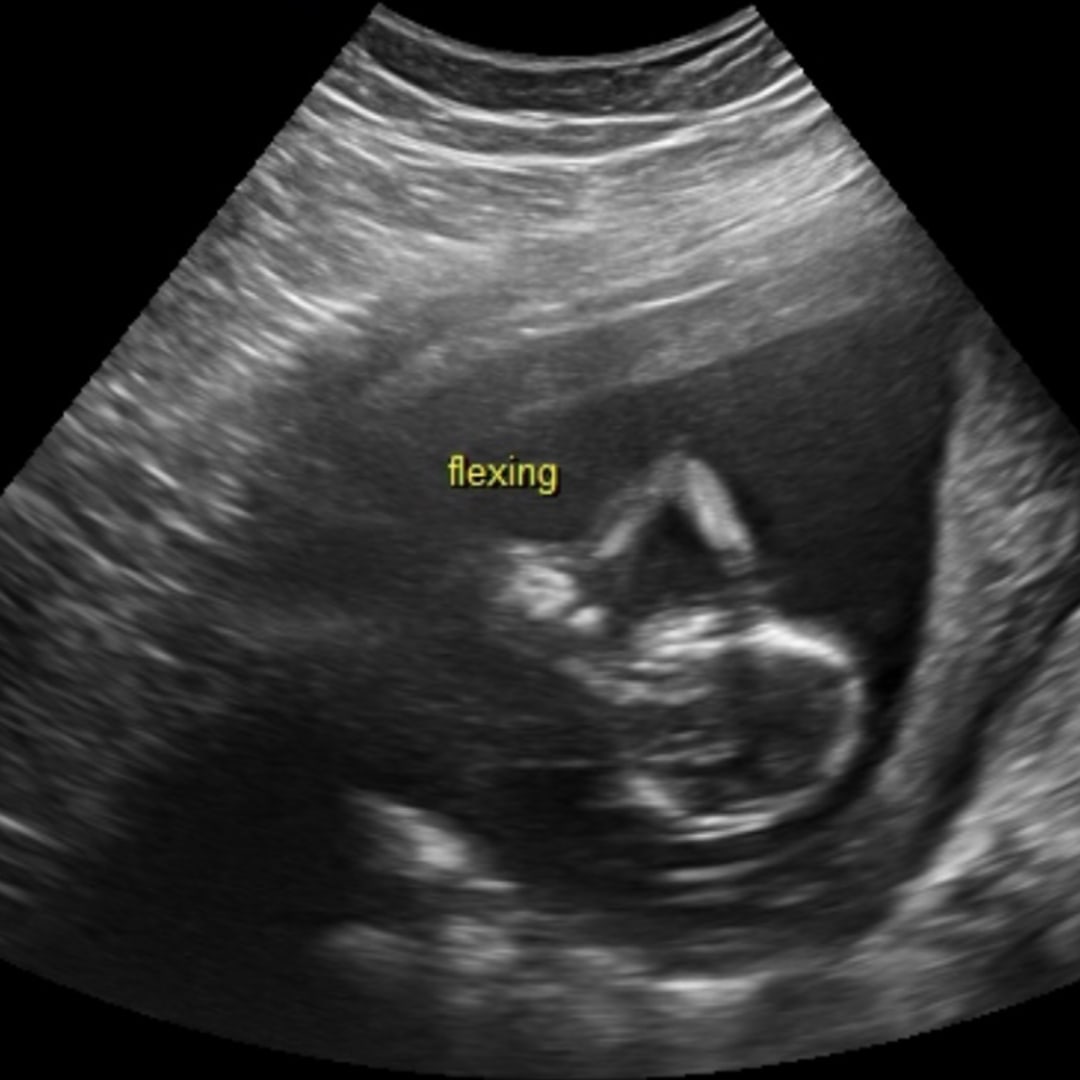 Photo shared by Kirsten for their Babylist baby registry.