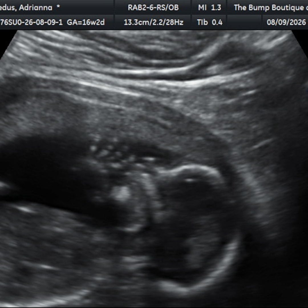 Photo shared by Adrianna for their Babylist baby registry.
