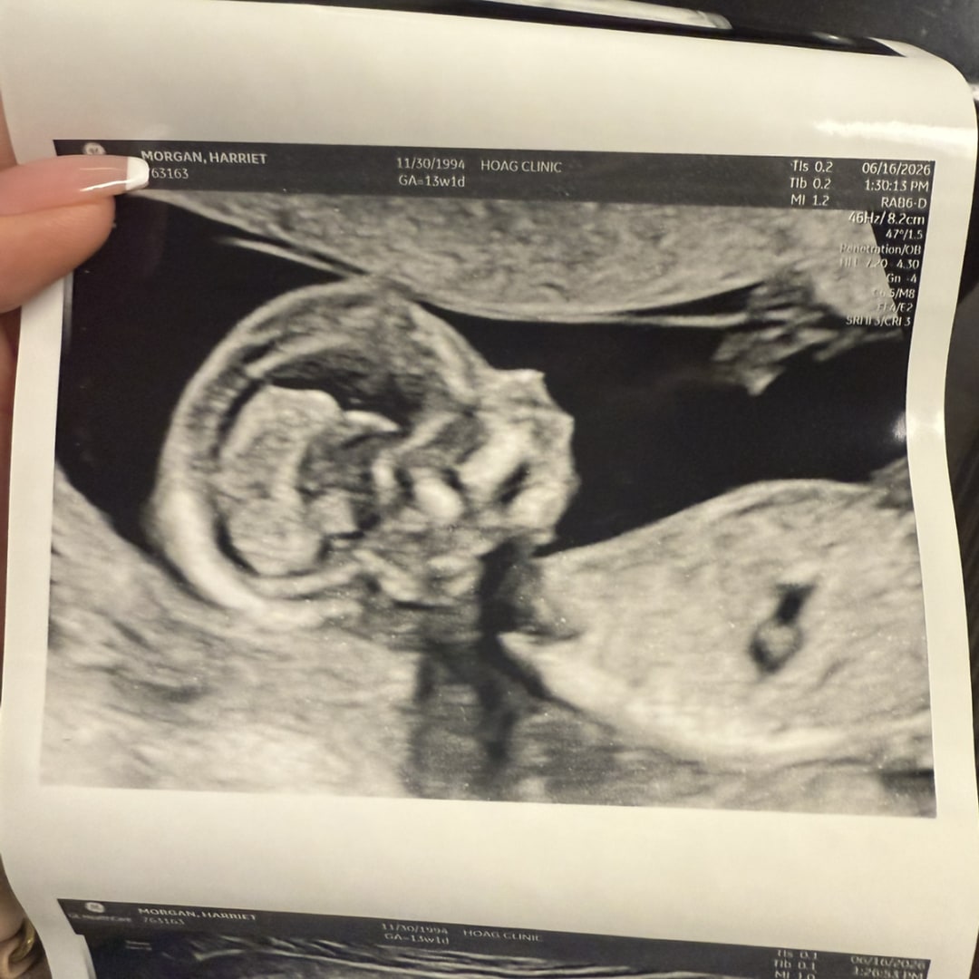 Photo shared by Harriet for their Babylist baby registry.