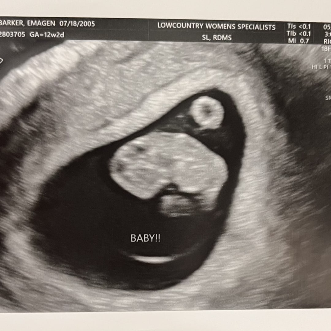 Photo shared by Emagen for their Babylist baby registry.