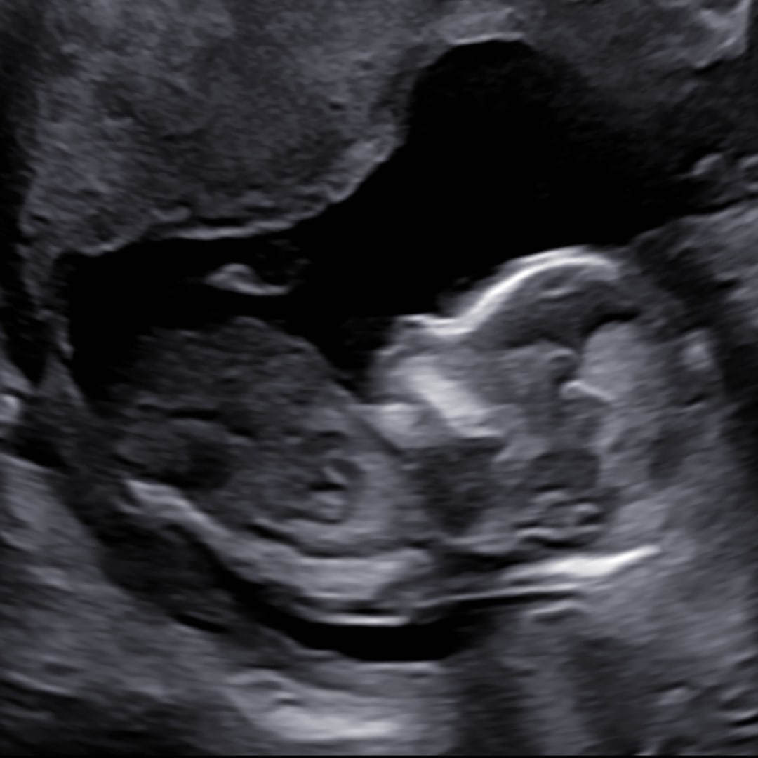 Photo shared by Lillian for their Babylist baby registry.