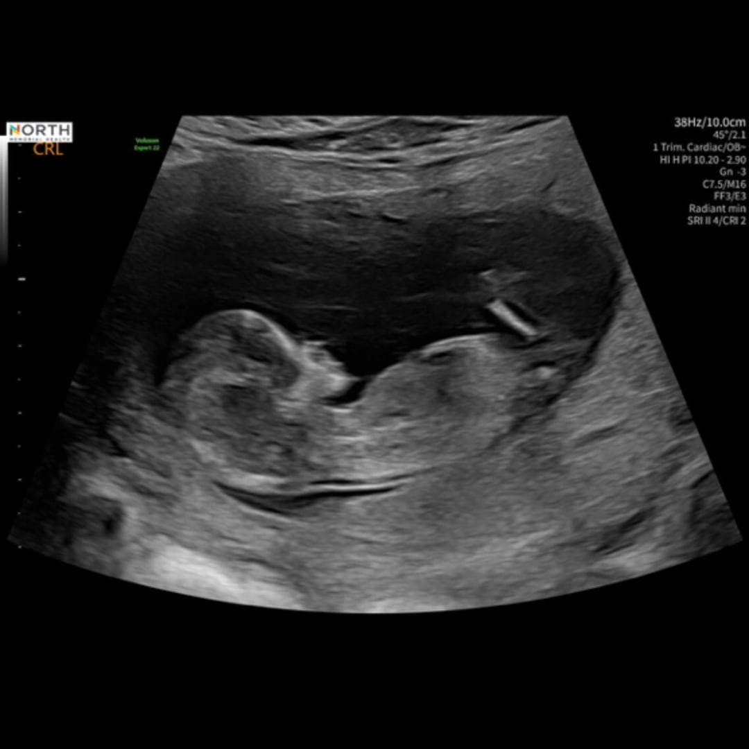 Photo shared by Jazmin for their Babylist baby registry.