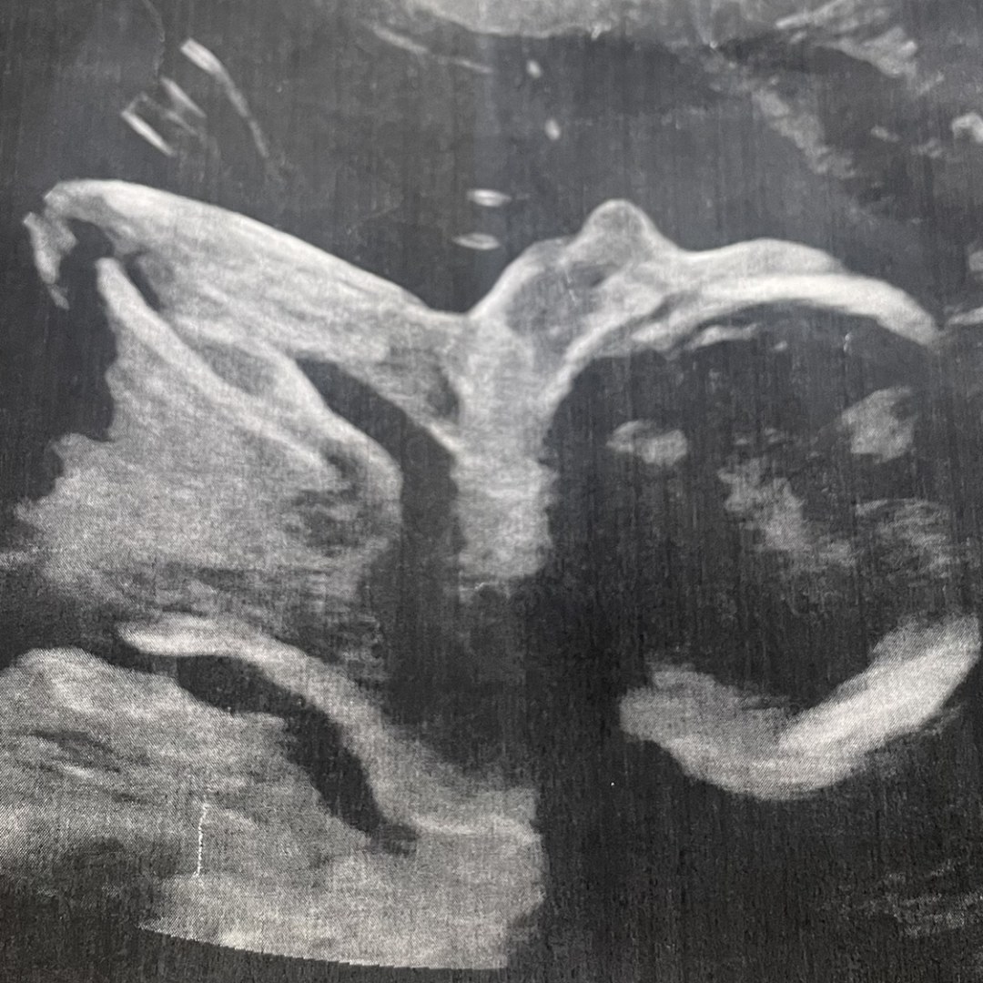 Photo shared by Alexis for their Babylist baby registry.