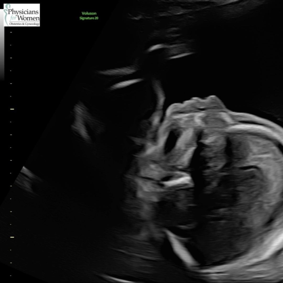 Photo shared by Christine for their Babylist baby registry.