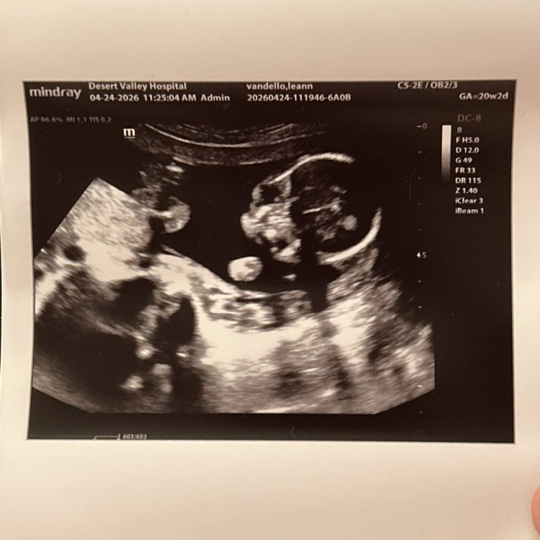 Photo shared by Leeann for their Babylist baby registry.