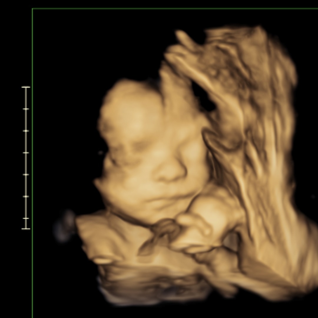 Photo shared by Emma for their Babylist baby registry.