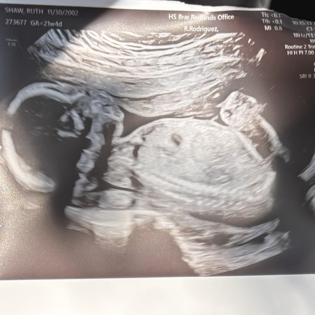 Photo shared by Ruth for their Babylist baby registry.
