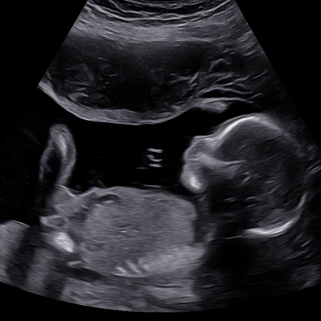 Photo shared by Jenna for their Babylist baby registry.