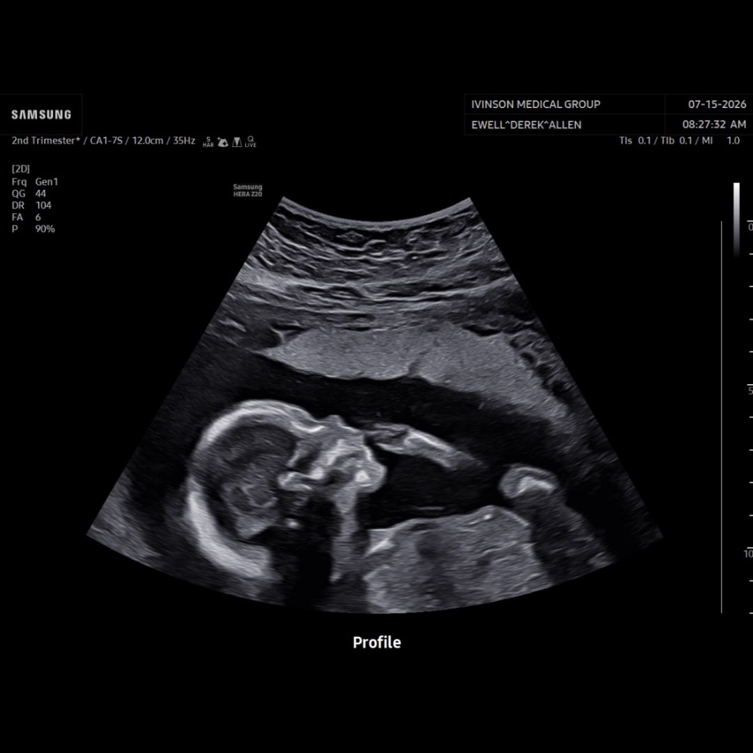 Photo shared by Harley for their Babylist baby registry.