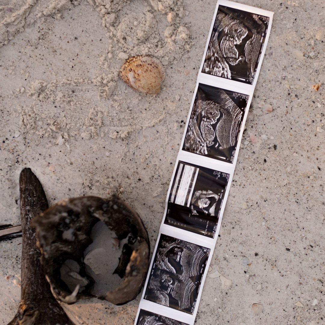 Photo shared by Amee for their Babylist baby registry.