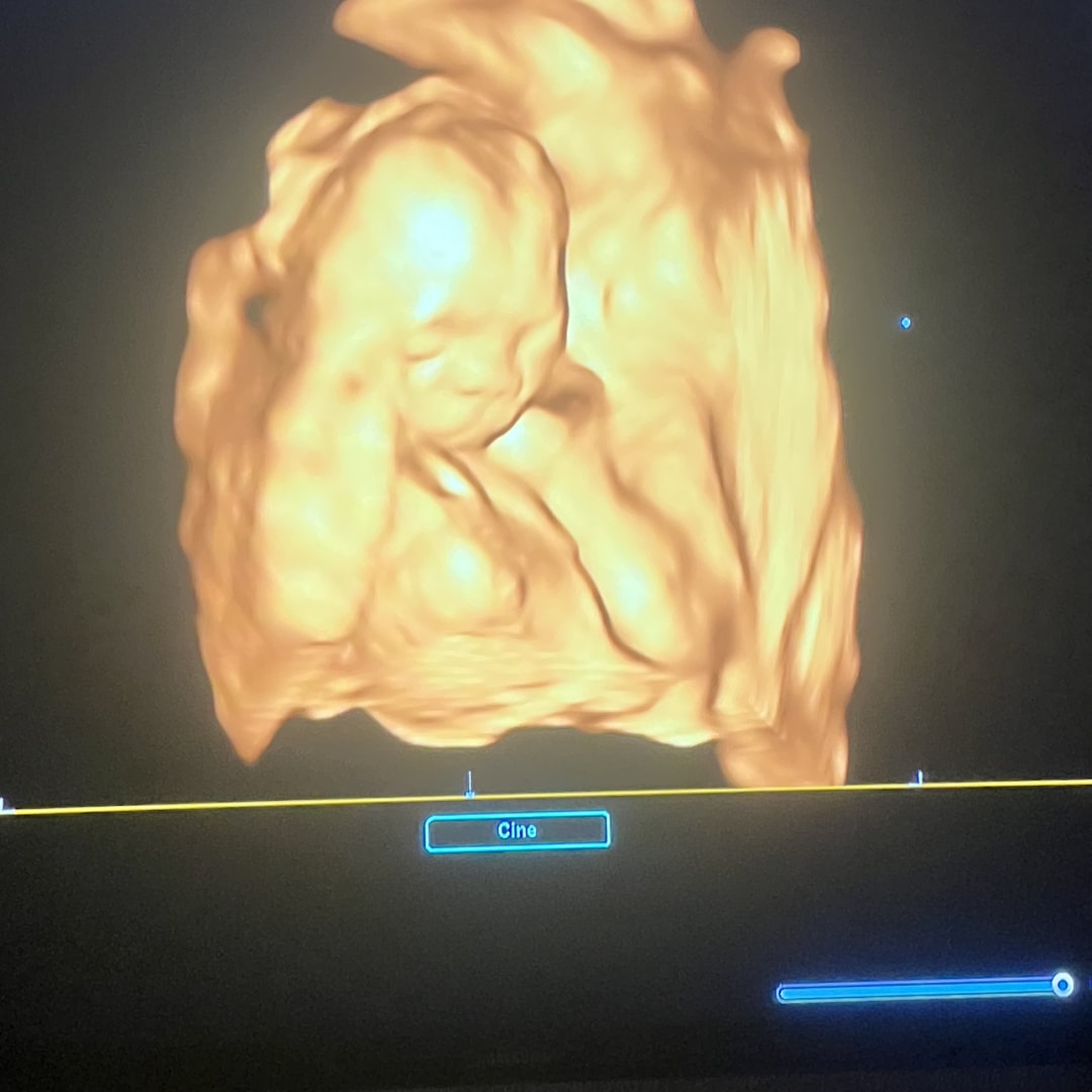 Photo shared by Christiana for their Babylist baby registry.