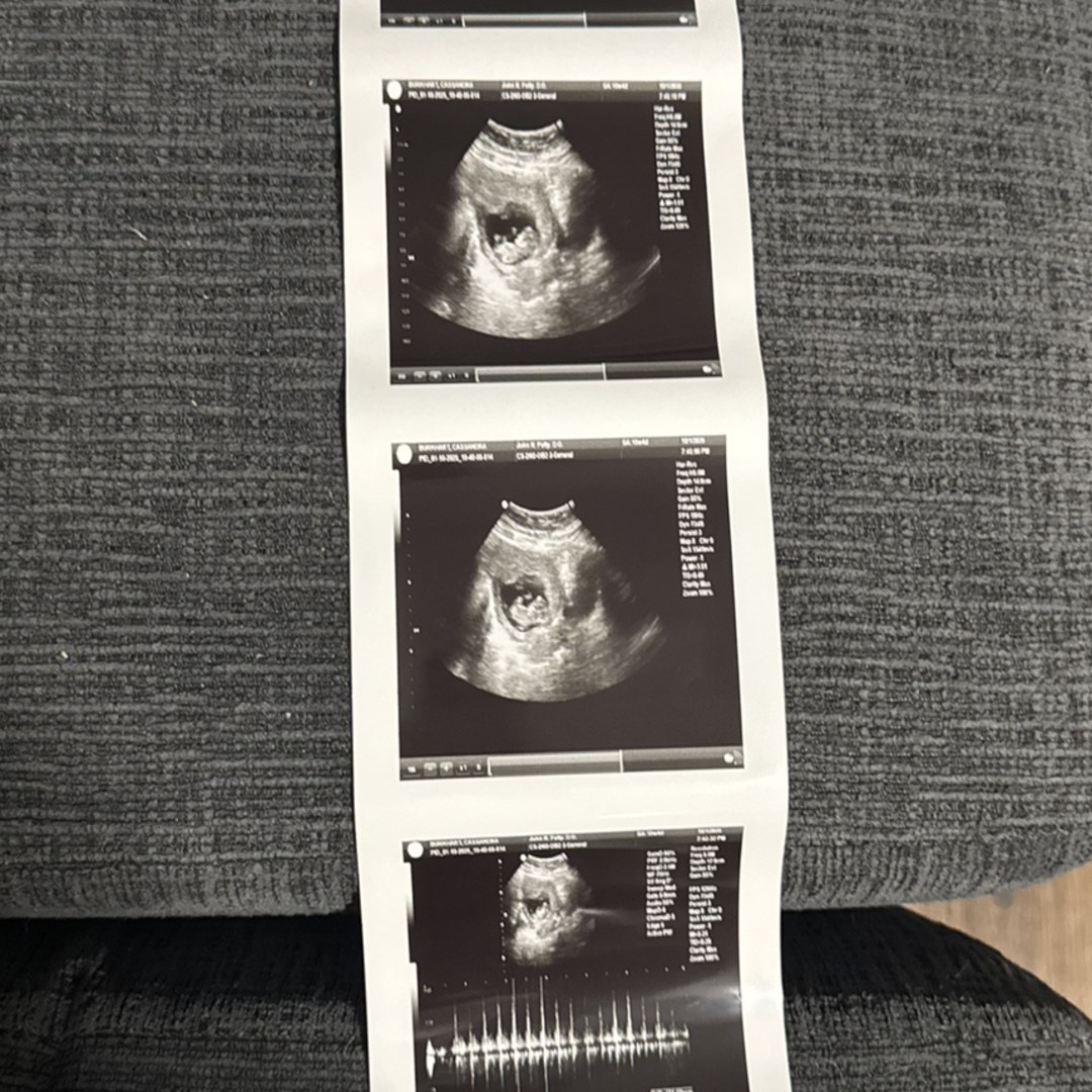 Photo shared by Cassandra for their Babylist baby registry.