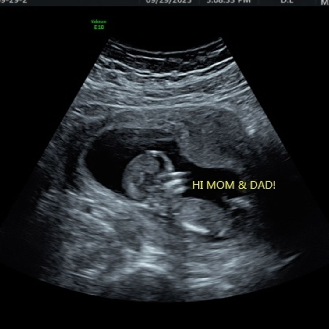 Photo shared by Emma for their Babylist baby registry.