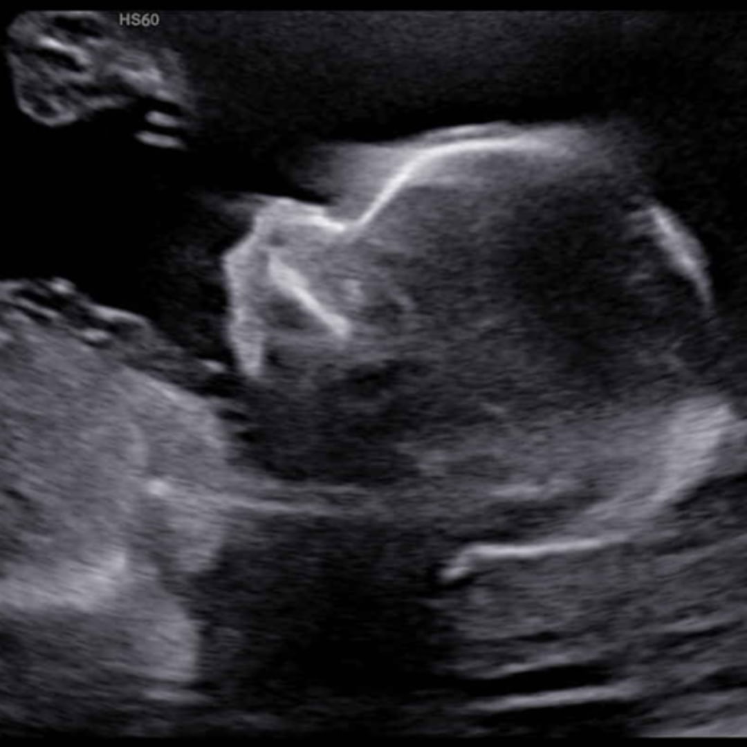 Photo shared by April for their Babylist baby registry.