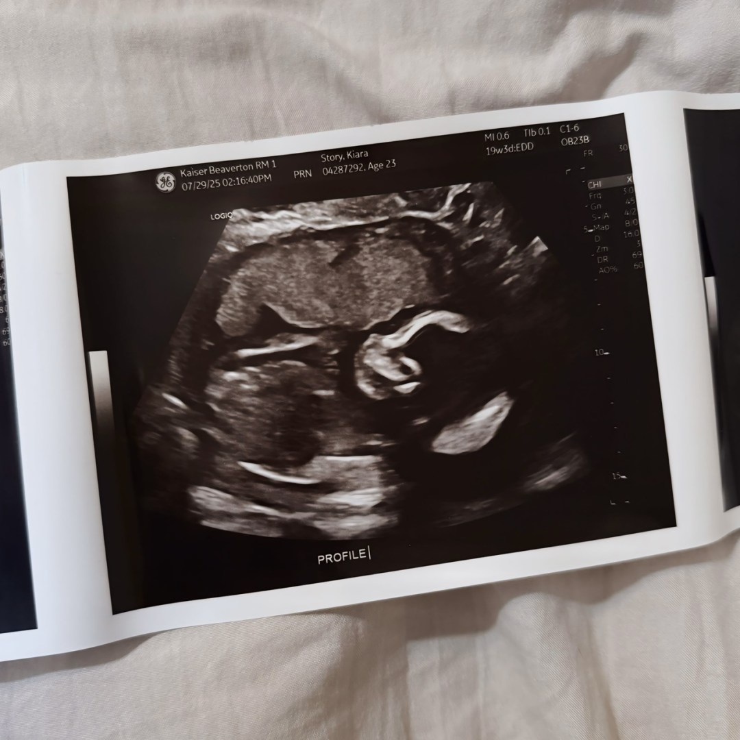 Photo shared by Kiara for their Babylist baby registry.