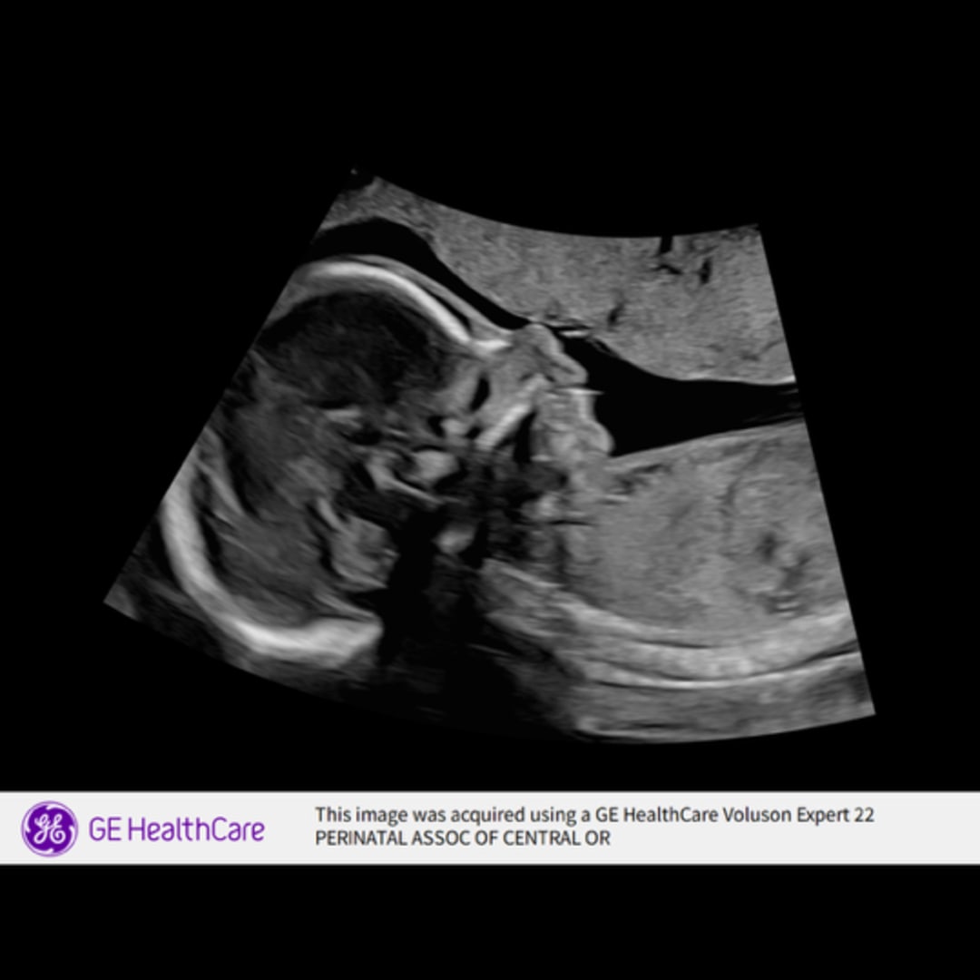 Photo shared by Sage for their Babylist baby registry.