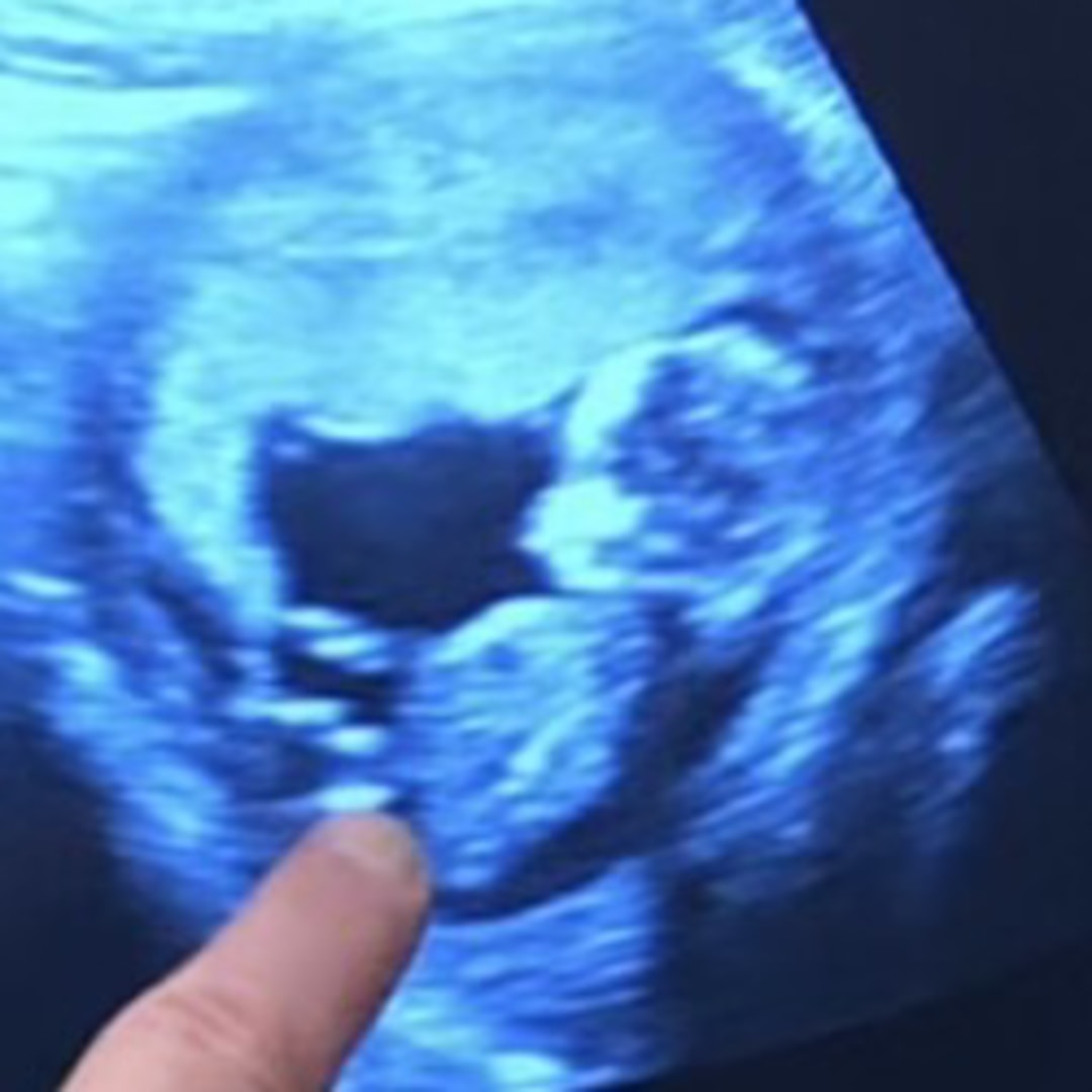 Photo shared by Anarely for their Babylist baby registry.