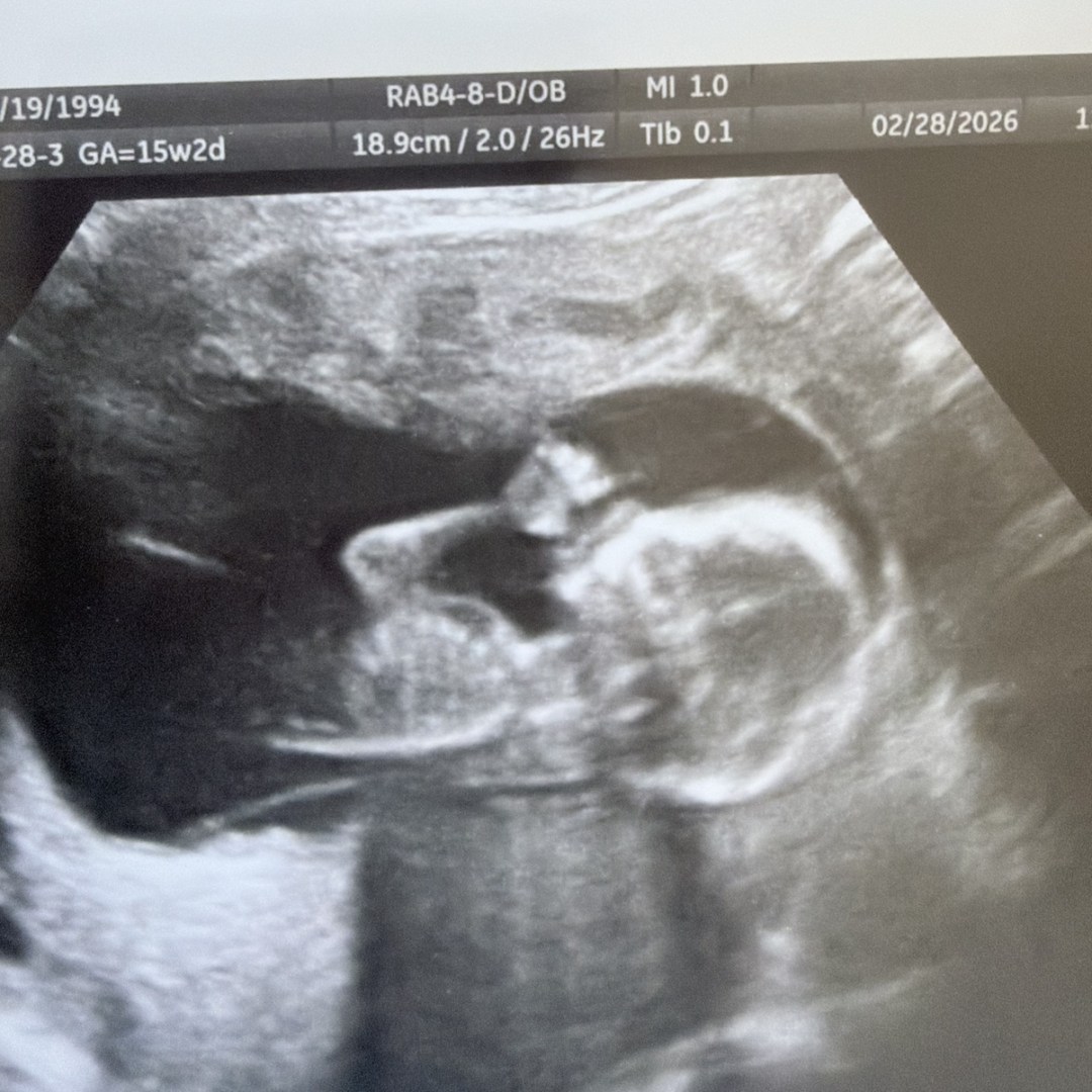Photo shared by Samantha for their Babylist baby registry.