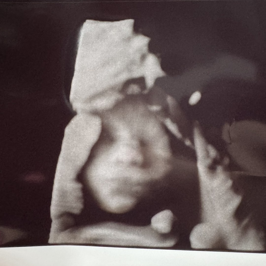 Photo shared by Malory for their Babylist baby registry.