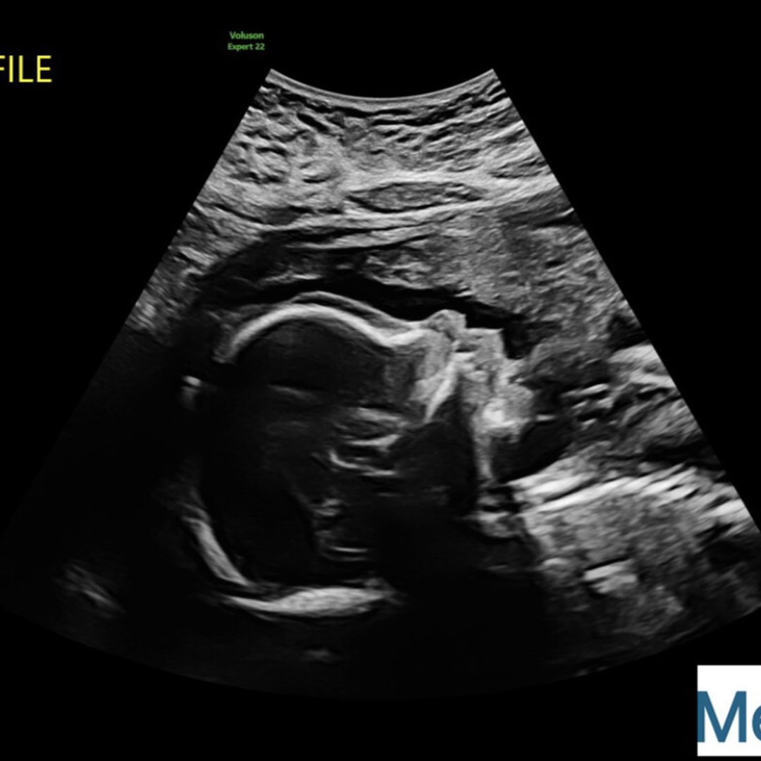 Photo shared by Erin for their Babylist baby registry.