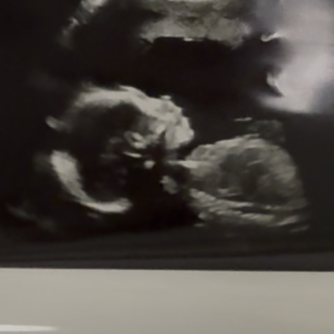 Photo shared by Rachelle for their Babylist baby registry.