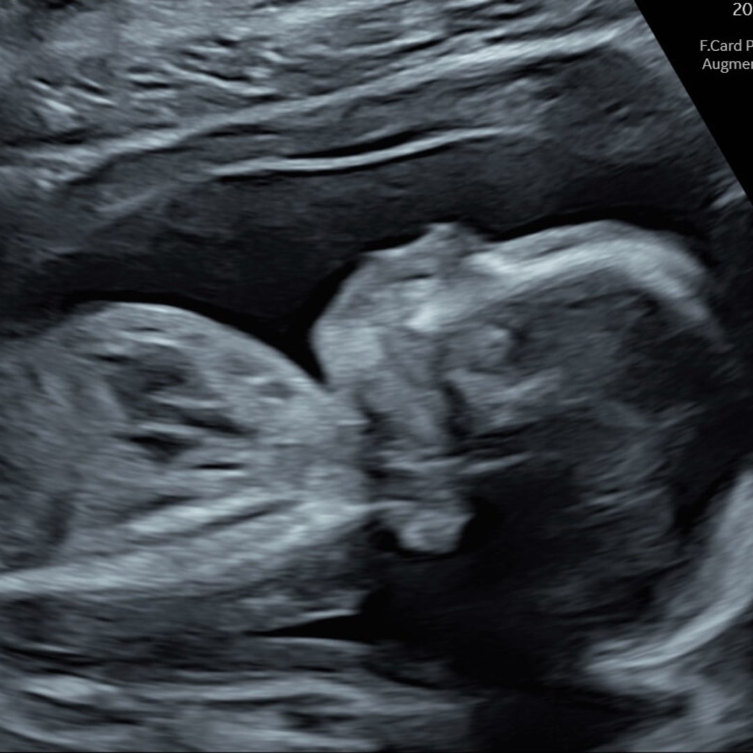 Photo shared by Lesley for their Babylist baby registry.