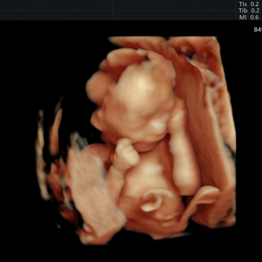 Photo shared by Darby for their Babylist baby registry.