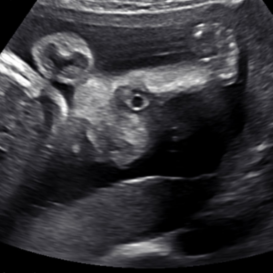 Photo shared by Roneesha for their Babylist baby registry.