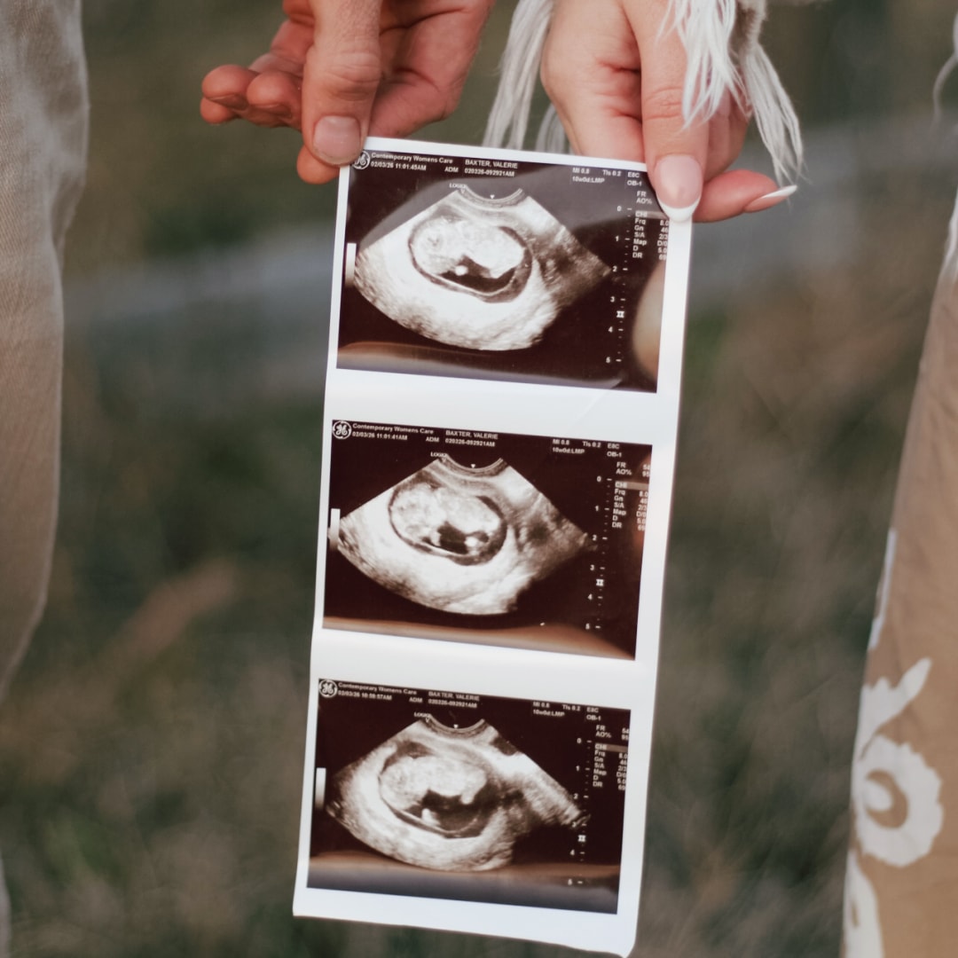 Photo shared by Valerie for their Babylist baby registry.