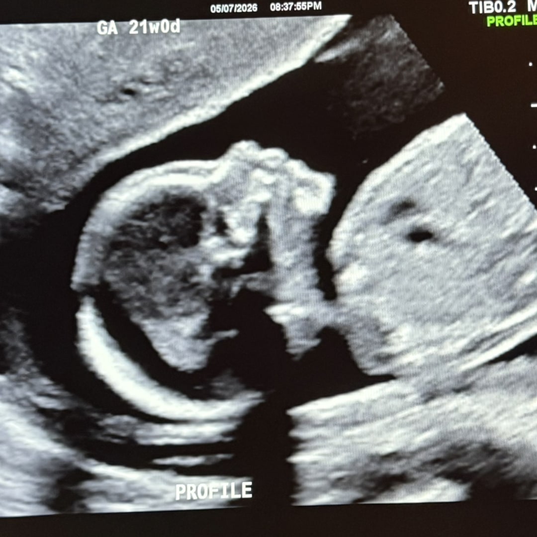 Photo shared by Shelby for their Babylist baby registry.