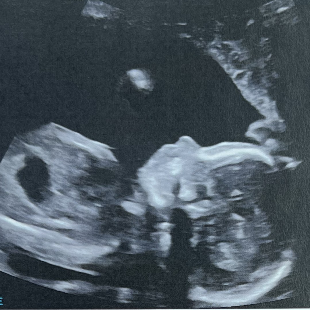 Photo shared by Ally for their Babylist baby registry.