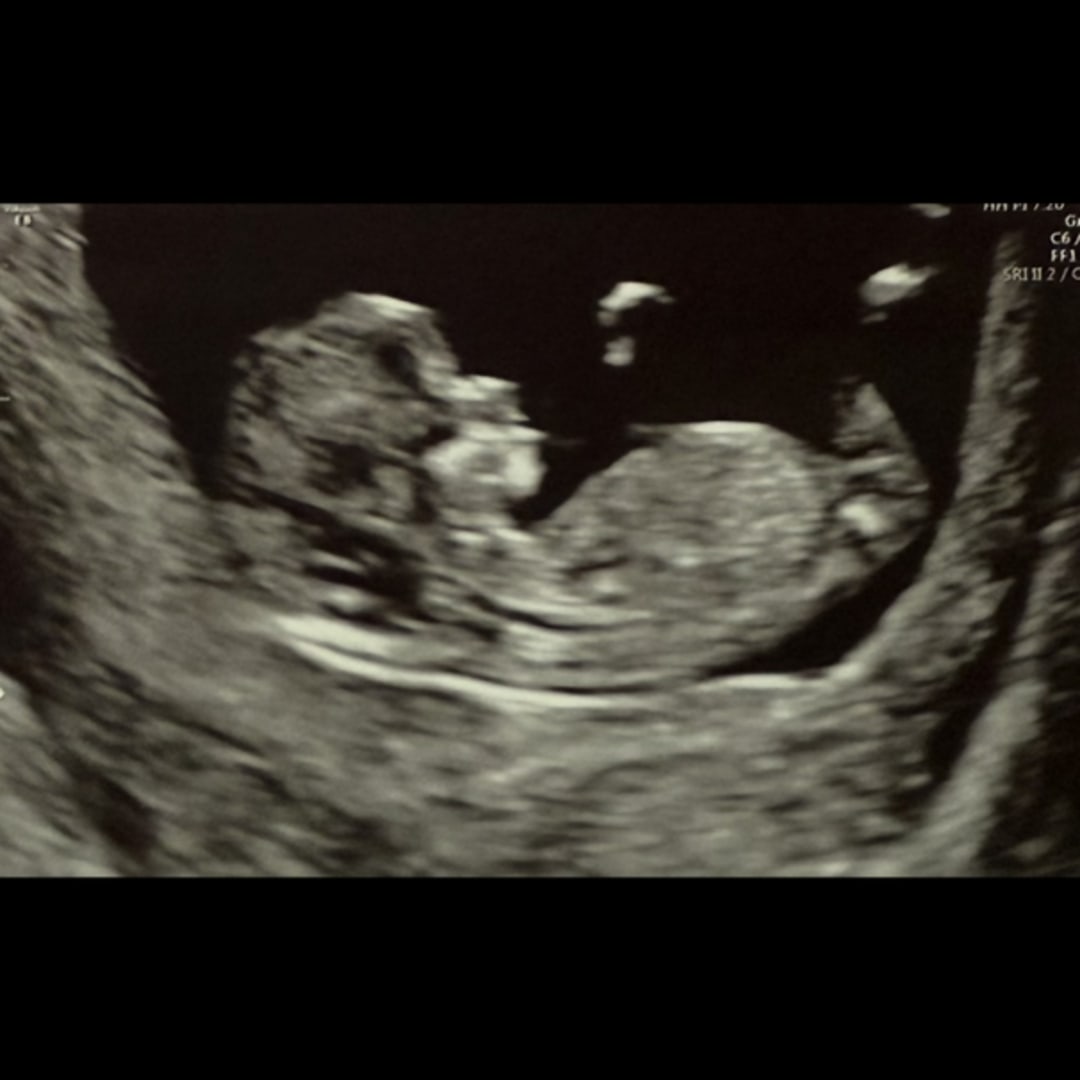 Photo shared by Catelynn for their Babylist baby registry.