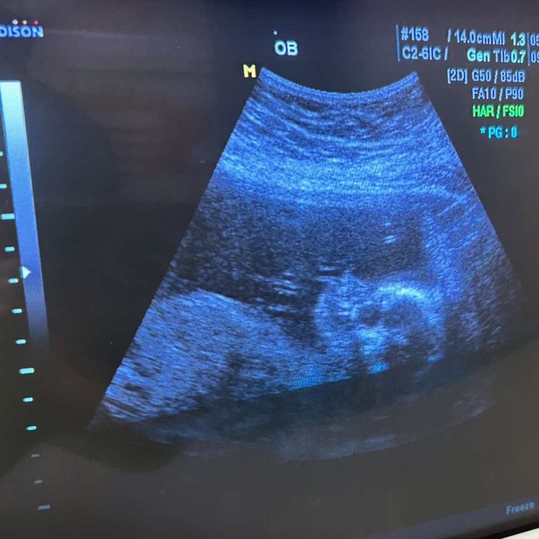Photo shared by Adrianna for their Babylist baby registry.