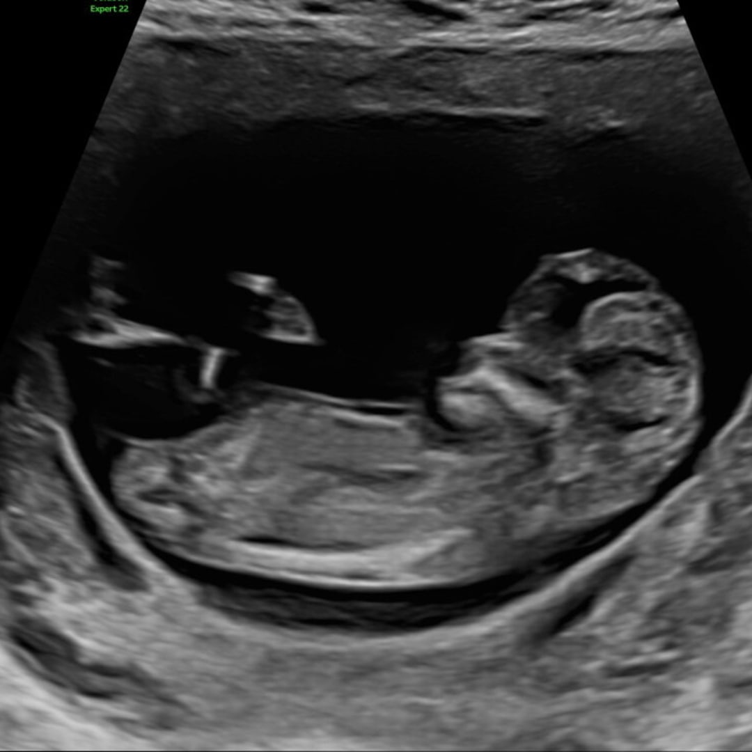 Photo shared by Alli for their Babylist baby registry.