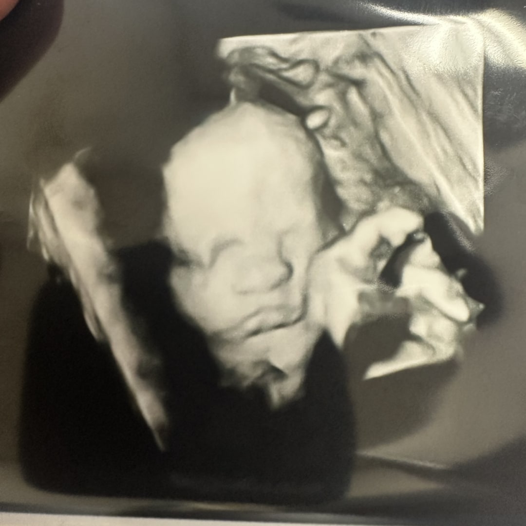 Photo shared by Lanae for their Babylist baby registry.