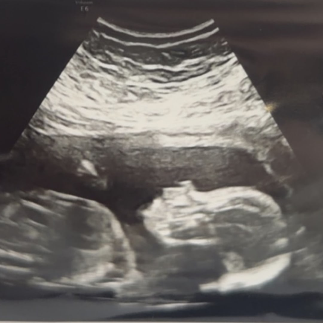 Photo shared by Joselin for their Babylist baby registry.