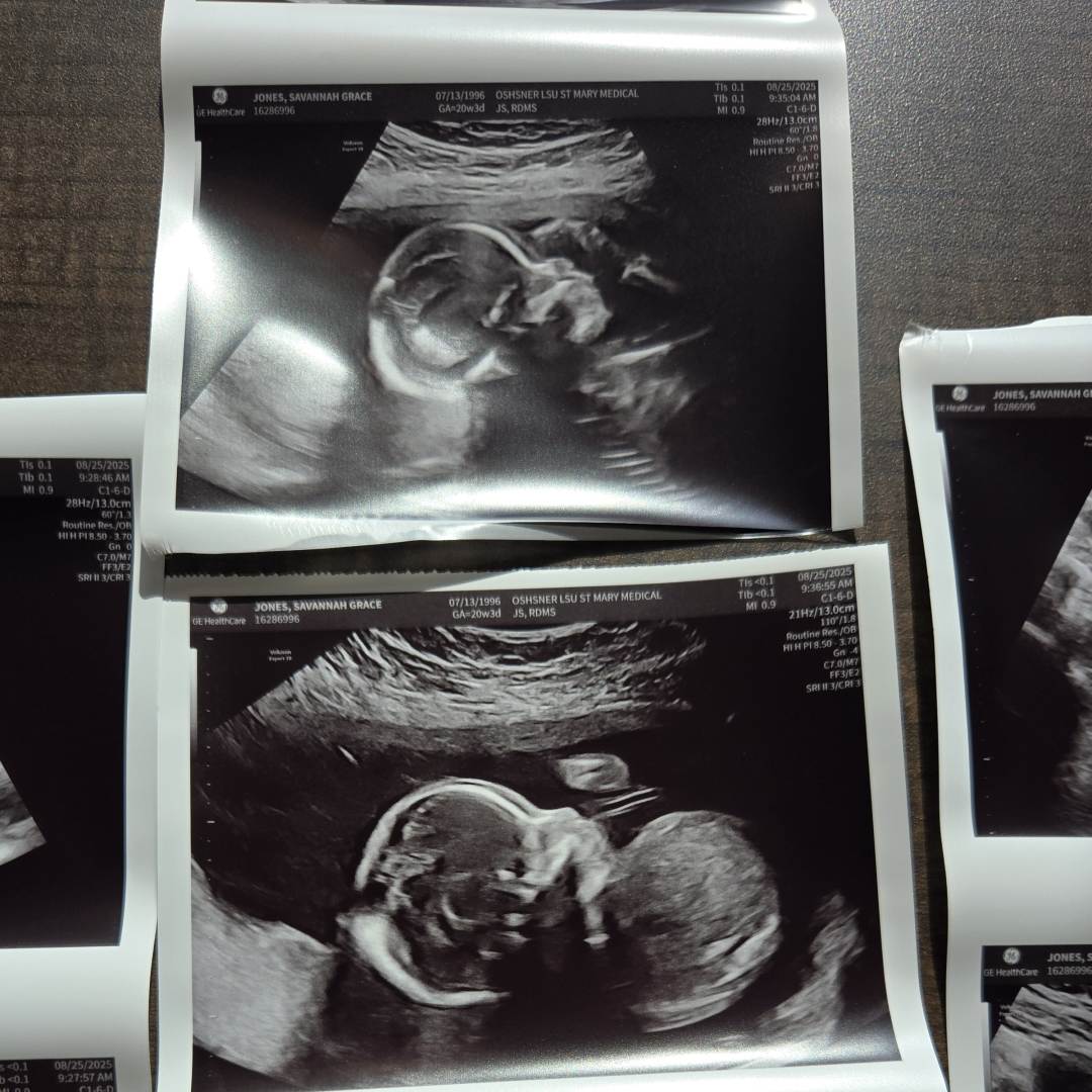 Photo shared by Savannah for their Babylist baby registry.