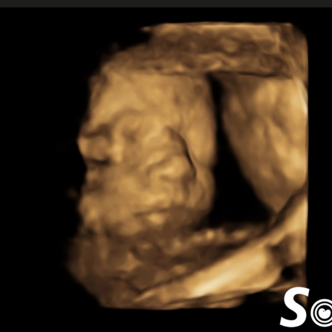 Photo shared by Jaiden for their Babylist baby registry.