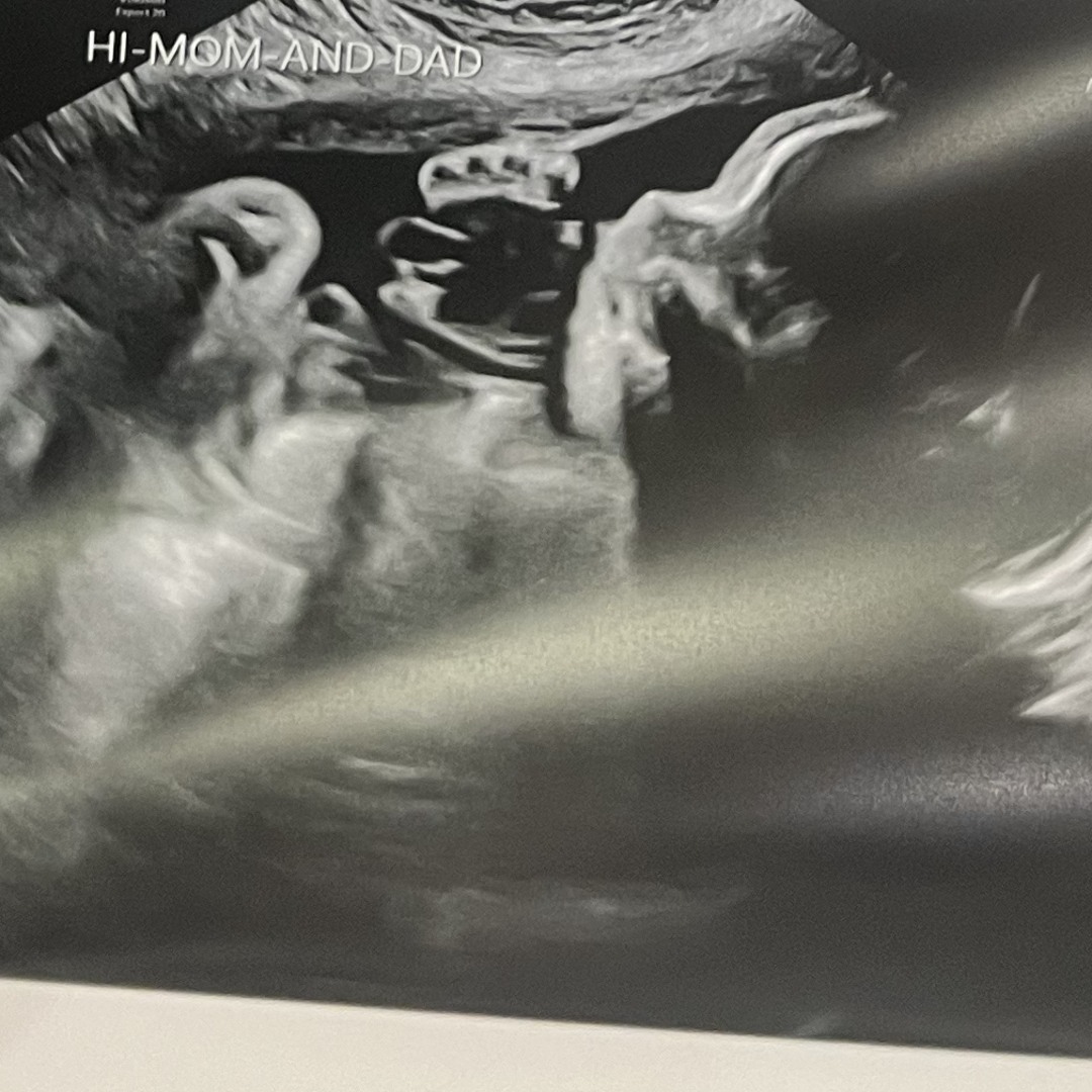 Photo shared by Kayla for their Babylist baby registry.