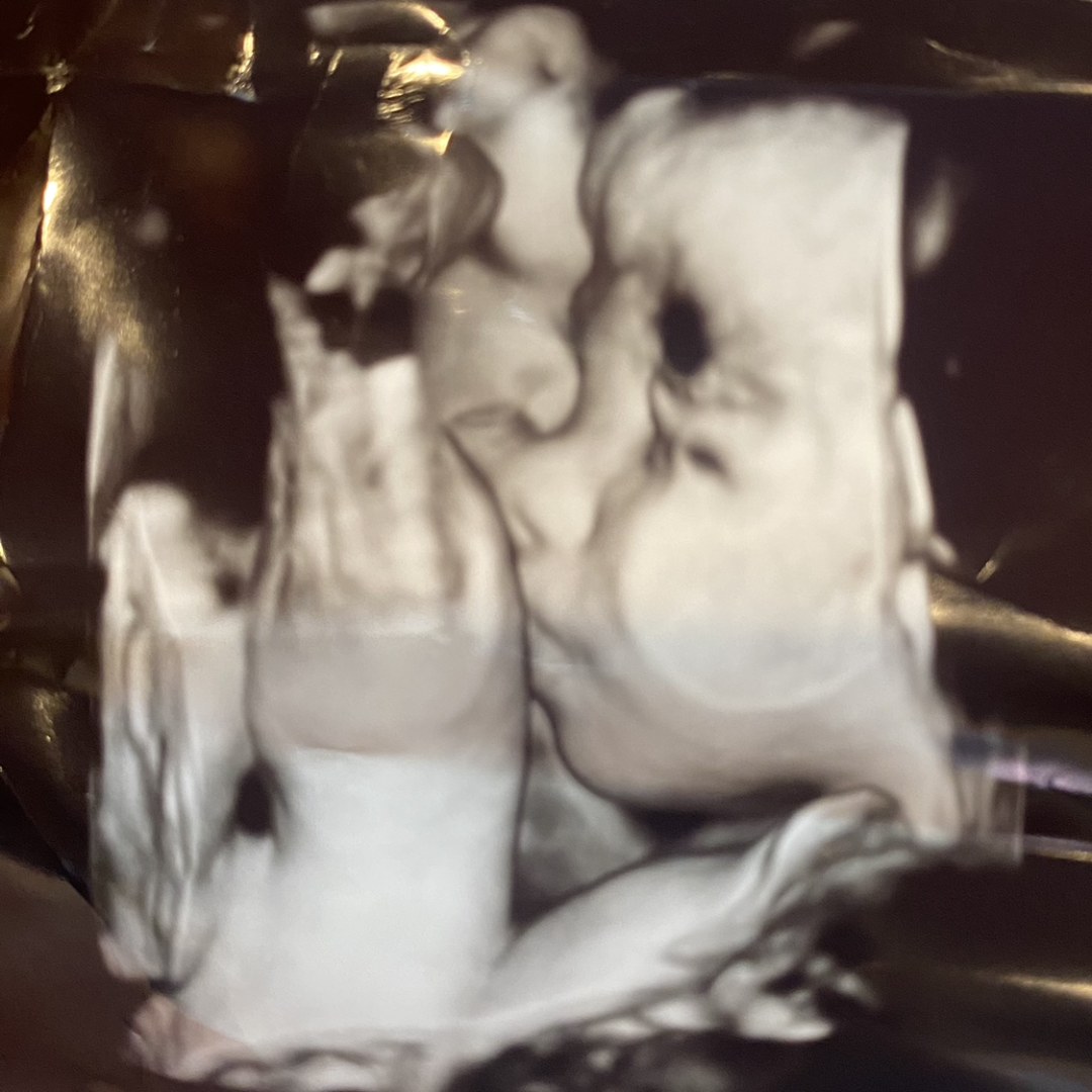 Photo shared by Brooke for their Babylist baby registry.