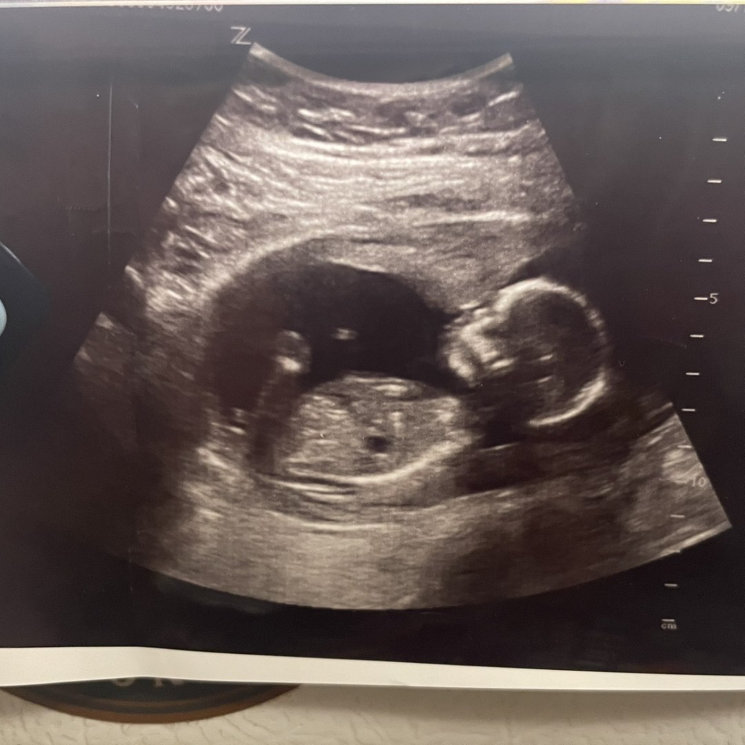 Photo shared by Annabel for their Babylist baby registry.