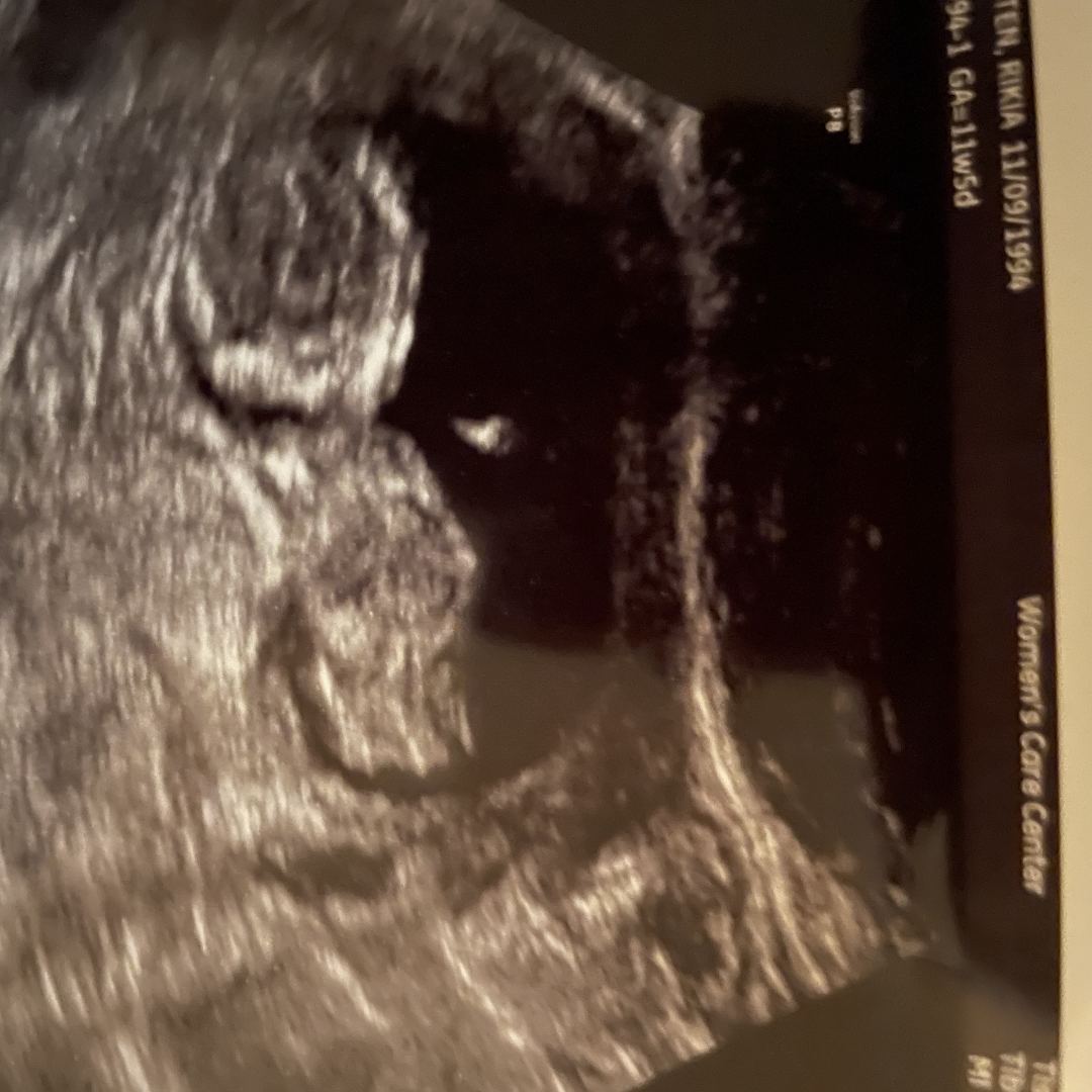 Photo shared by Rikia for their Babylist baby registry.