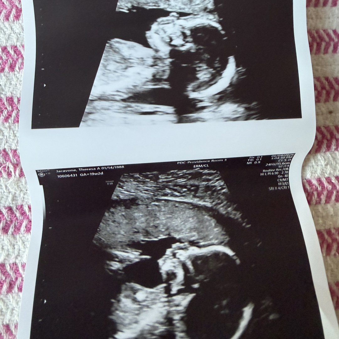 Photo shared by Theresa for their Babylist baby registry.