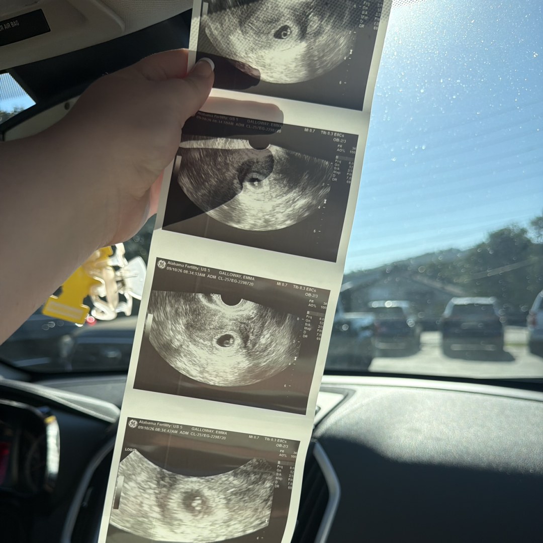 Photo shared by Emma for their Babylist baby registry.